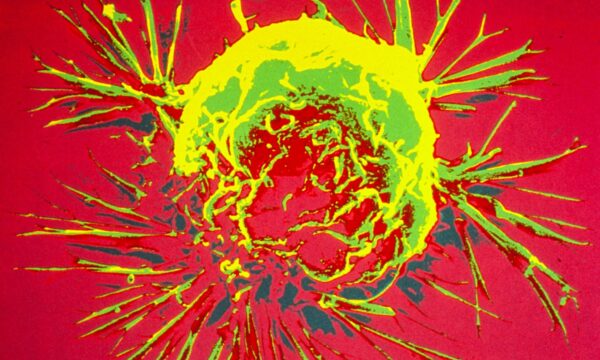 Cientistas modificam bactérias para combater câncer